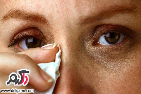 علت درد چشم در افراد چیست؟