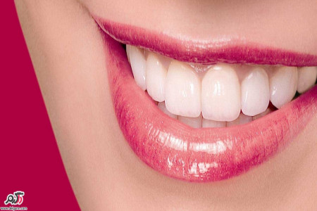 تقویت لثه؛گیاهان دارویی مناسب برای تقویت لثه و دندان ها