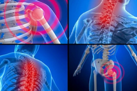 میوزیت (آماس ماهیچه) ؛ نشانه ها، علل، درمان و ۶ راه طبیعی برای کنترل آن