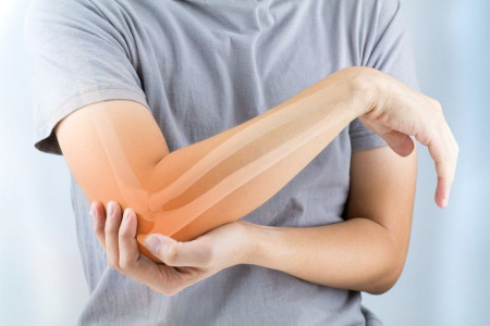 چگونه بفهمیم استخوان شکسته جوش خورده است ؟