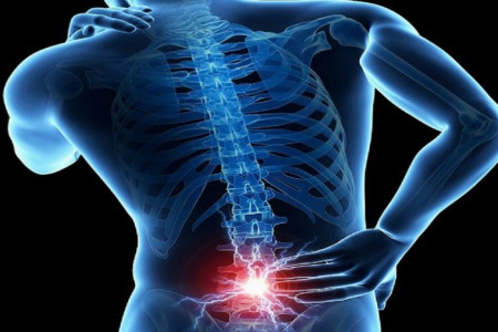 فرسایش دیسک کمر (دیسک سیاه) چیست و چه علائمی دارد ؟