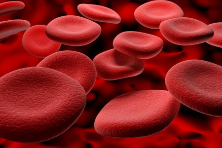 علائم اضافه بار آهن چیست و چگونه درمان میشود ؟