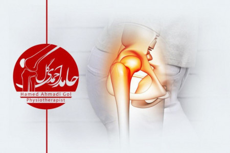 فیزیوتراپی در منزل | فیزیوتراپی سکته مغزی