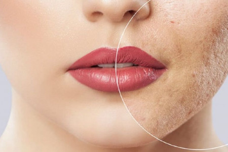 مراقبت های بعد از سابسیژن