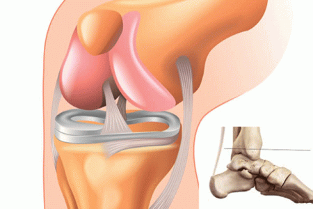 آیا رباط همان تاندون است ؟