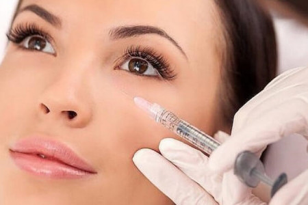 همه چیز در مورد تزریق ژل زیر چشم