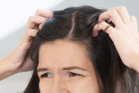 ۱۴ علت اصلی بروز زخم پوست سر چیست ؟