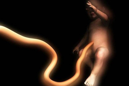 استخراج، نگهداري و استفاده از سلولهاي بنيادي بند ناف