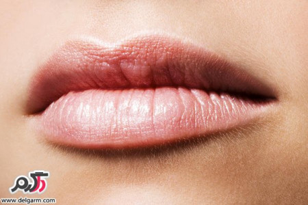 آیا میدانید ترک گوشه لب نشانه چیست؟