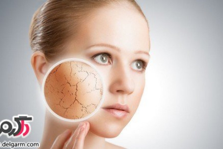 توصیه های طب سنتی برای پوست های خشک