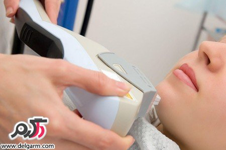 دانستنی هایی در رابطه با لیزر موهای زائد