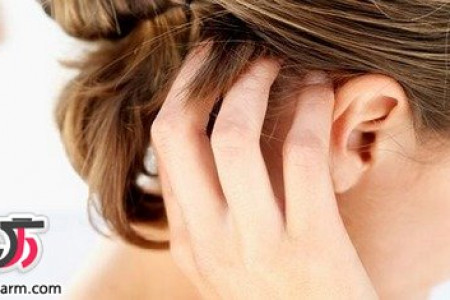 روش های تسکین دهنده خارش پوست سر