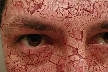 نکات طلایی برای افراد دارای پوست خشک