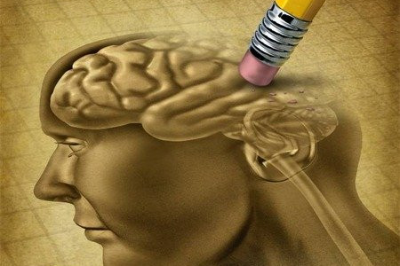 معرفی نشانه های اولیه مبتلا شدن به آلزایمر