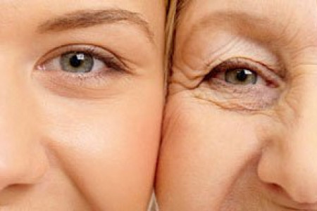 بهترین درمان ها برای چین و چروک اطراف چشم کاملترین مقاله