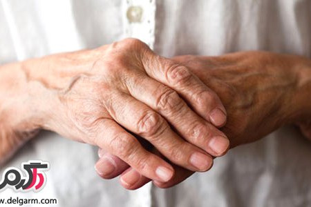 همه چیز در مورد عارضه روماتولوژی