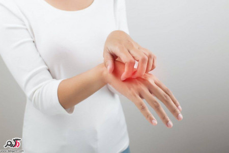 راه های مناسب برای پیشگیری از اگزما پوستی