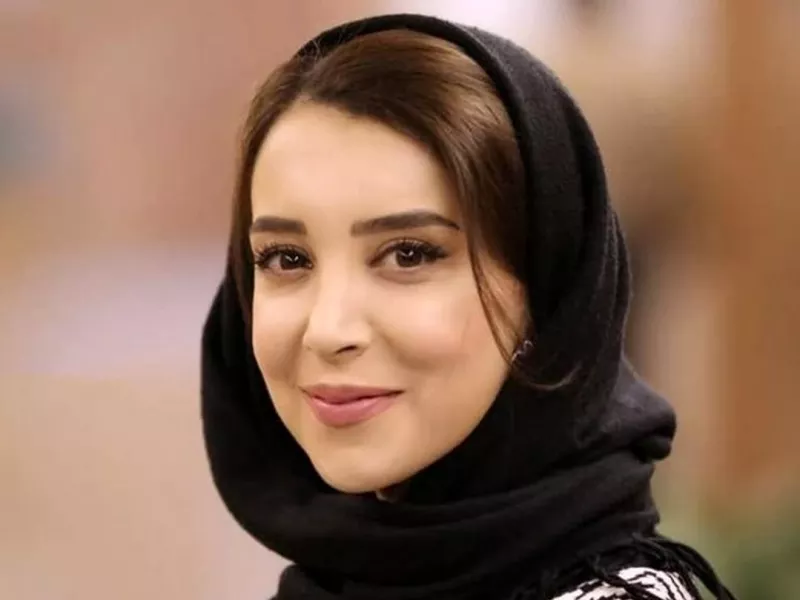 سحر جعفری جوزانی بعد از فلج صورت به این شکل درآمد !