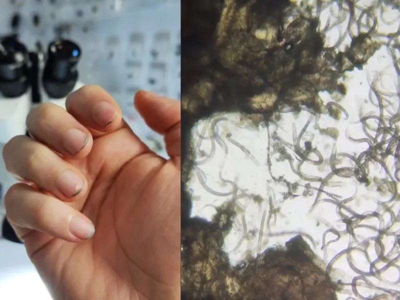 زیرناخن‌های کثیف در دنیای میکروسکوپی چه خبره؟ 🤢😱