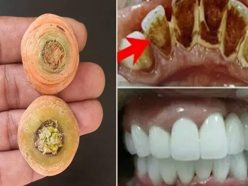 یه ترفند ساده و فوری برای پاک شدن جرم دندانها در 2 دقیقه !