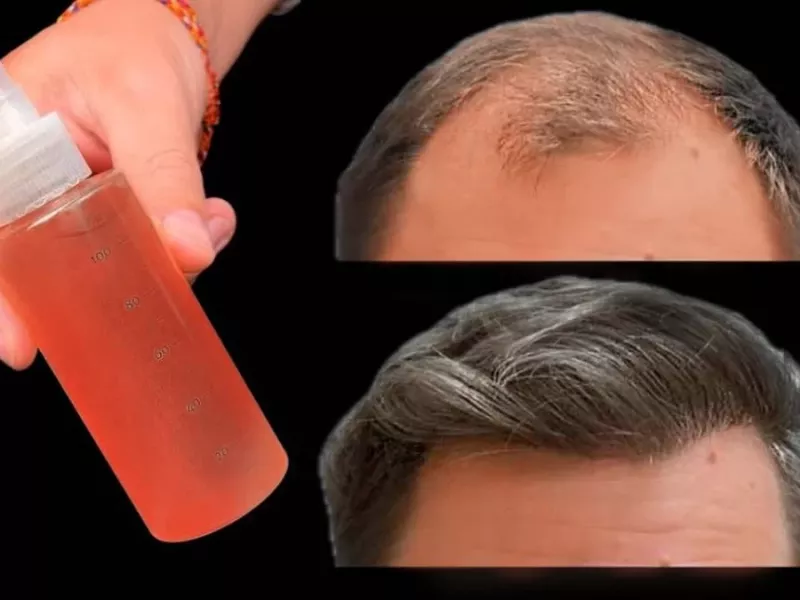 راز ژاپنی ها در درمان و تقویت مو با چای !!