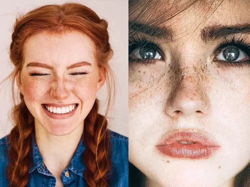 توییتر گردی اندر وصف زیبایی کک و مک!