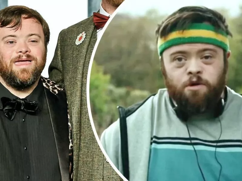 با جیمز مارتین، اولین بازیگر مبتلا به سندروم داون که برنده اسکار شد، آشنا شوید!