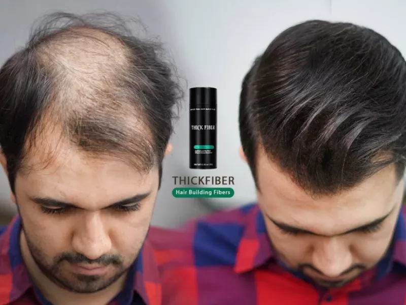 مدل مو برای موهای بسیار نازک و طاس با استفاده از الیاف مو !